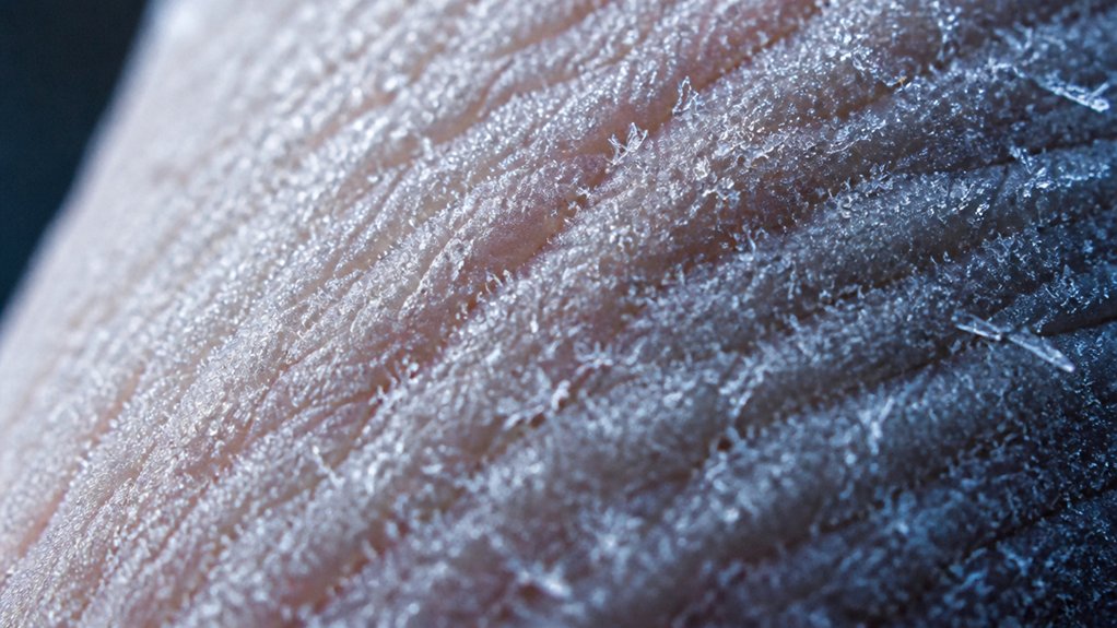 excessive vasoconstriction cold symptoms